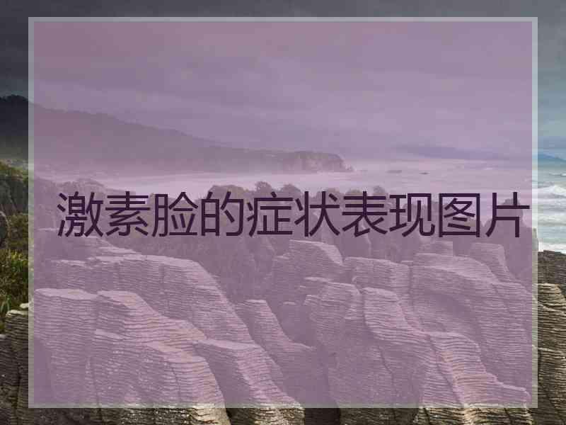 激素脸的症状表现图片
